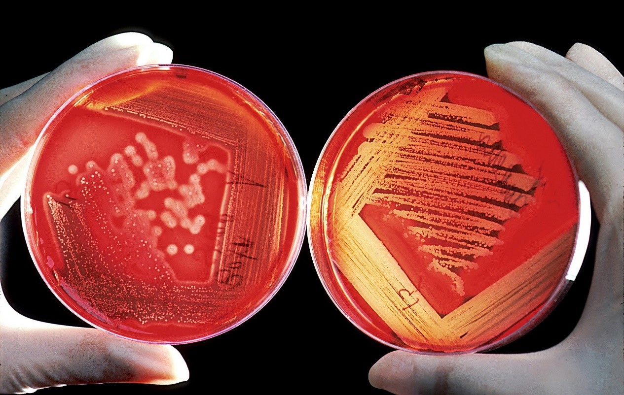 Bacterial Plates